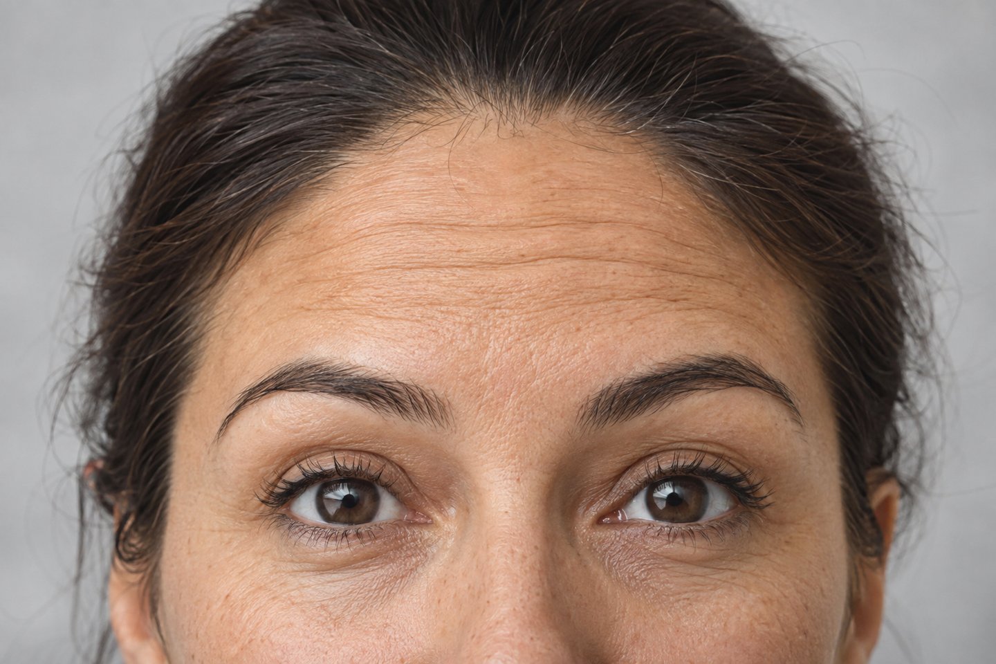 Illustrative close-up of natural horizontal forehead expression lines