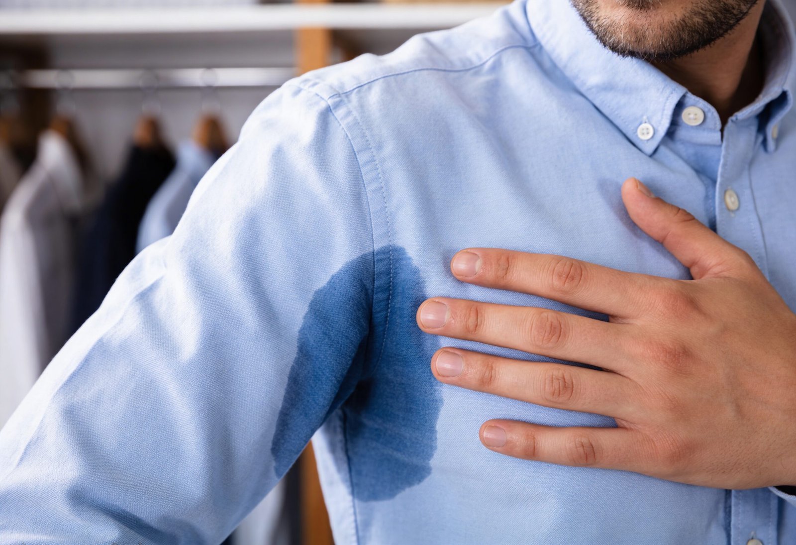 Botox Hyperhidrosis treatment planning