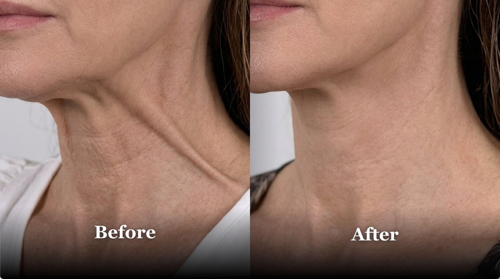 Sharper Jawline