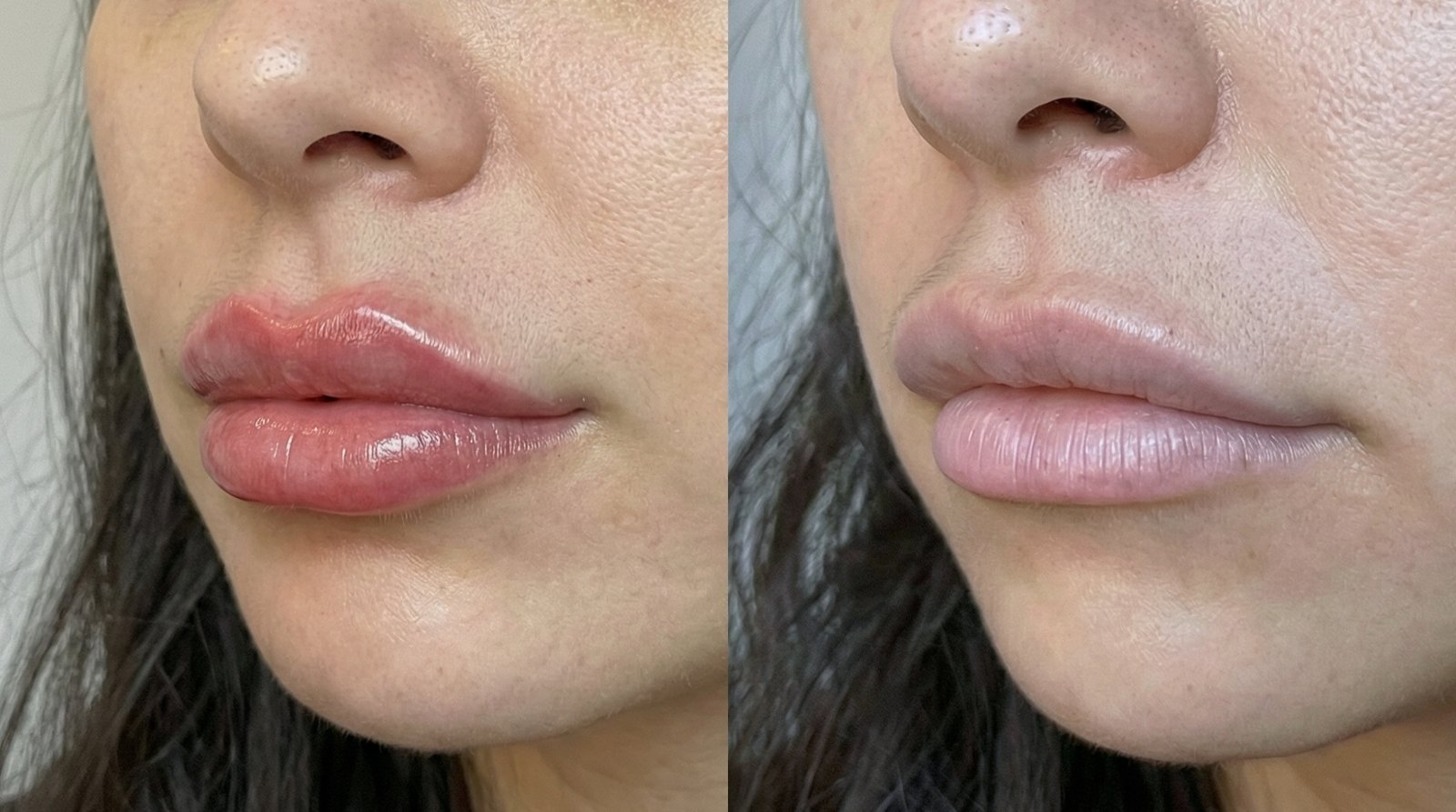 Shape Correction